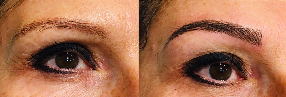 Sourcils semi-permanents ou Microblading, restructurer un sourcil de façon très naturelle.