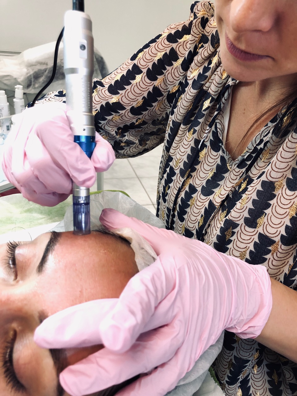Soin anti-âge (Microneedling) - Institut Duo Beauté