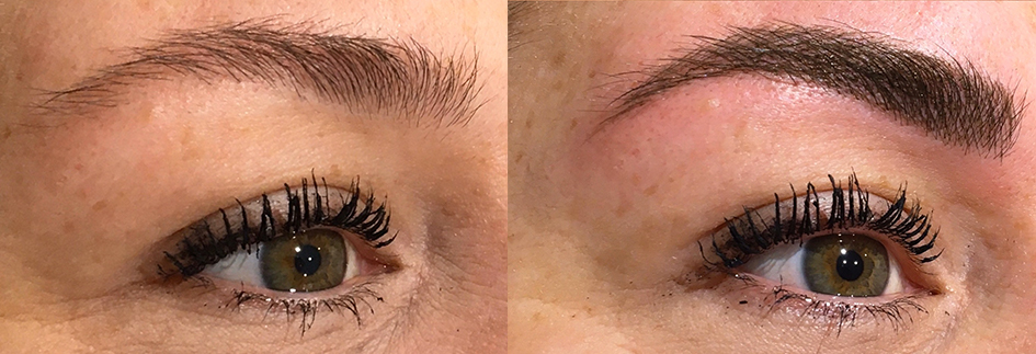 Sourcils semi-permanents ou Microblading, restructurer un sourcil de façon très naturelle.