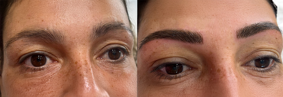 Sourcils semi-permanents ou Microblading, restructurer un sourcil de façon très naturelle.